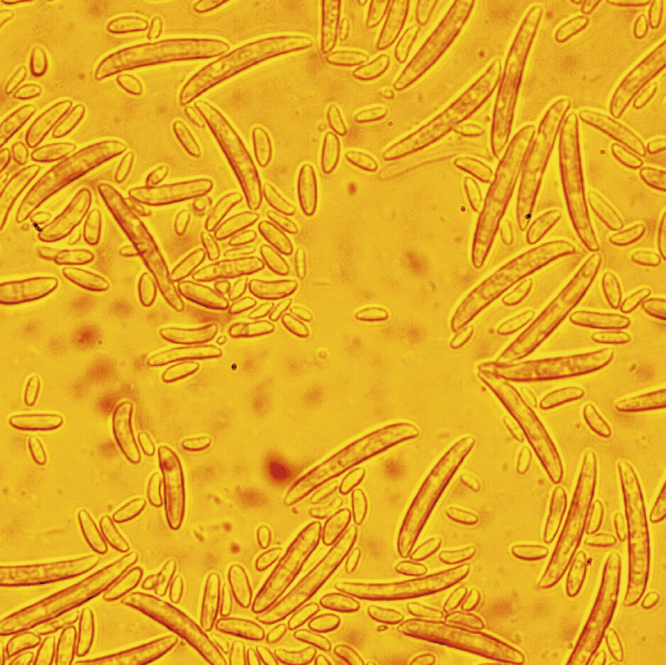 Фузариоз колоса: что&nbsp;делать?